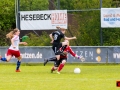 2015-05-17-SVHU-HSV1-0095.jpg